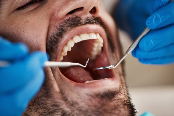 Best Emergency Dentist for Knocked-Out Tooth in Mathis, TX