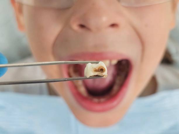 Best Weekend Emergency Dentist in Mathis, TX